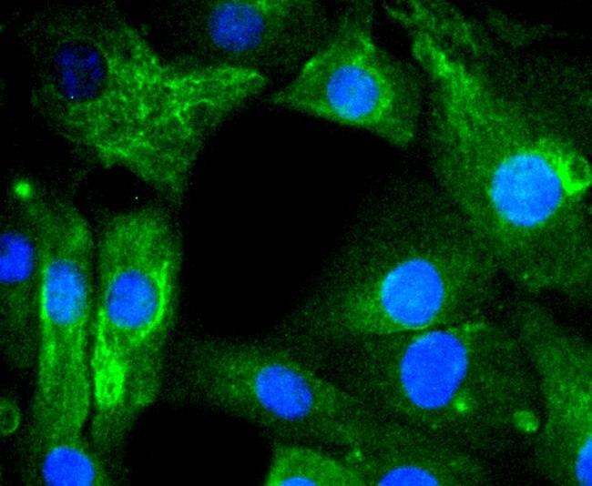 AGR2 Antibody in Immunocytochemistry (ICC/IF)