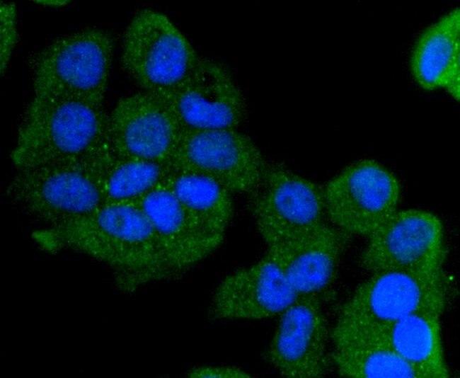 Cytokeratin 13 Antibody in Immunocytochemistry (ICC/IF)