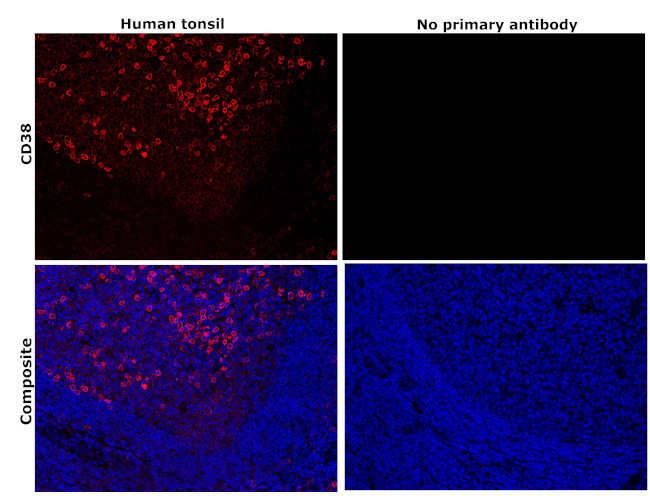 CD38 Antibody in Immunohistochemistry (Paraffin) (IHC (P))