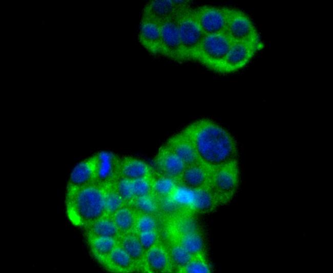 SIRT2 Antibody in Immunocytochemistry (ICC/IF)