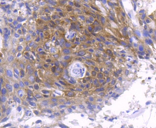 Phospho-PKC zeta (Thr560) Antibody in Immunohistochemistry (Paraffin) (IHC (P))