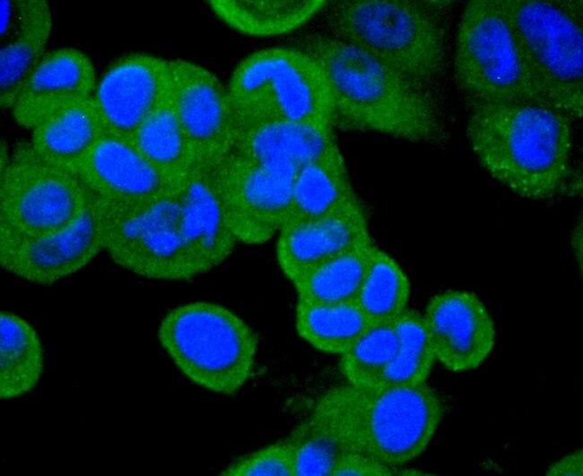 CD10 Antibody in Immunocytochemistry (ICC/IF)