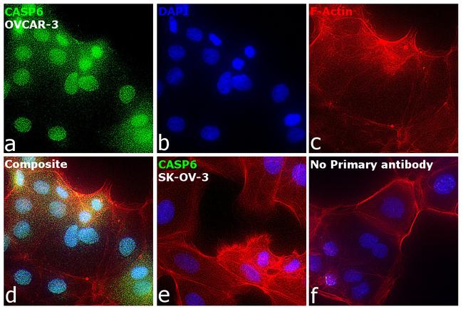 Caspase 6 p18 Antibody in Immunocytochemistry (ICC/IF)