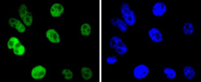 Cyclin H Antibody in Immunocytochemistry (ICC/IF)