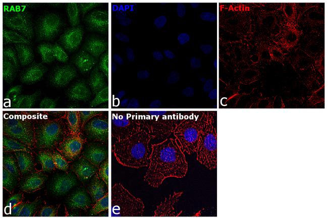 RAB7A Antibody in Immunocytochemistry (ICC/IF)