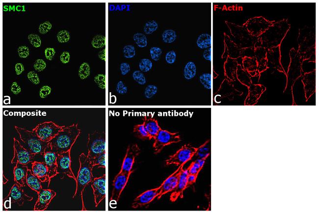 SMC1 Antibody in Immunocytochemistry (ICC/IF)