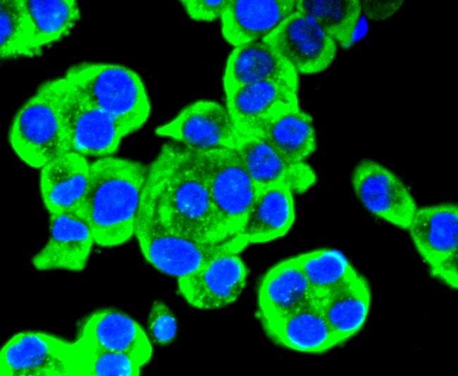 RET Antibody in Immunocytochemistry (ICC/IF)