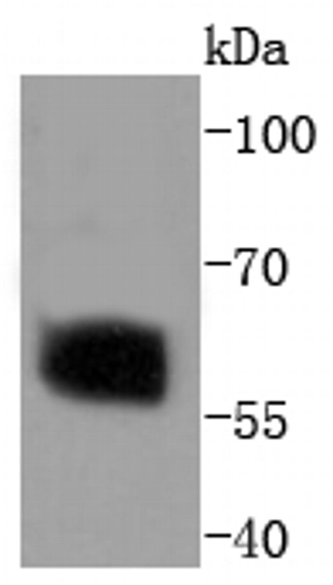 Phospho-SMAD2 (Ser250) Antibody in Western Blot (WB)