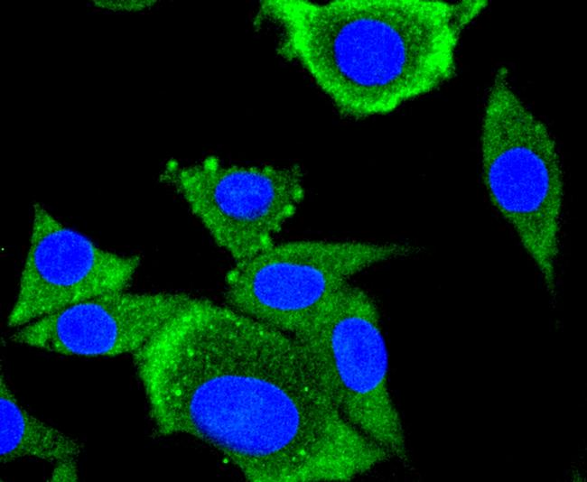 AP2M1 Antibody in Immunocytochemistry (ICC/IF)