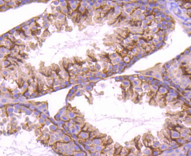 STIM1 Antibody in Immunohistochemistry (Paraffin) (IHC (P))