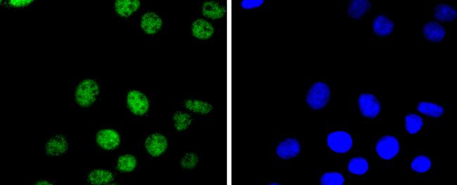 PAX8 Antibody in Immunocytochemistry (ICC/IF)