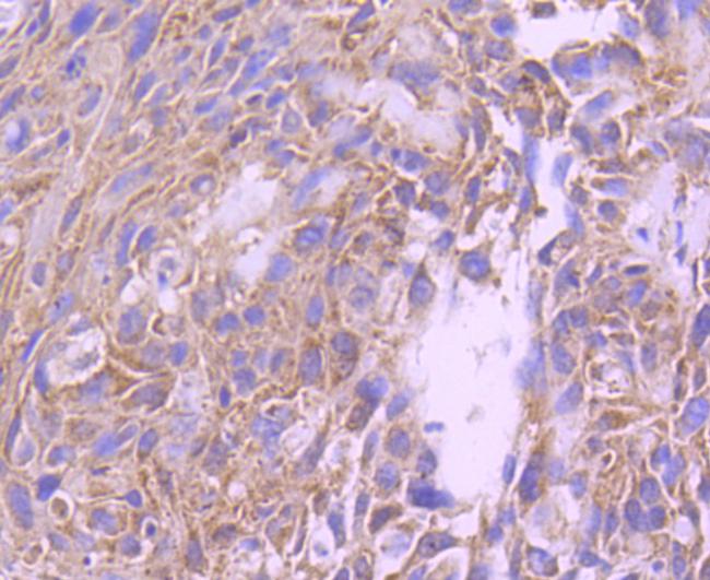 FOXO4 Antibody in Immunohistochemistry (Paraffin) (IHC (P))