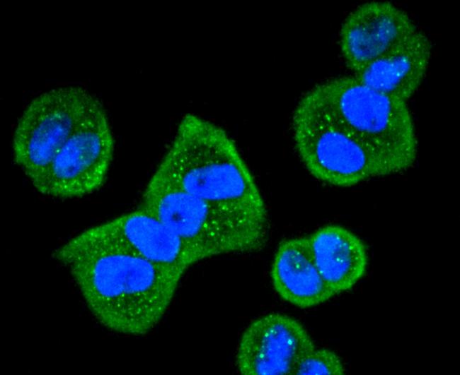 HDAC10 Antibody in Immunocytochemistry (ICC/IF)