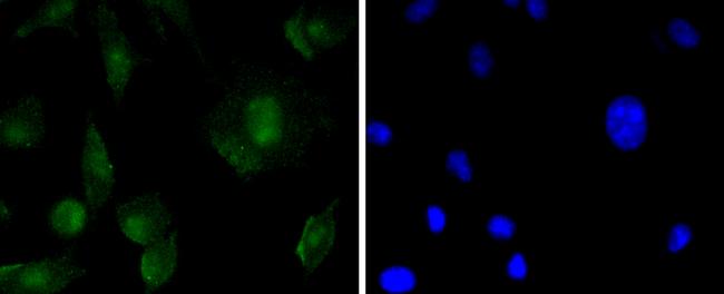 SOX11 Antibody in Immunocytochemistry (ICC/IF)