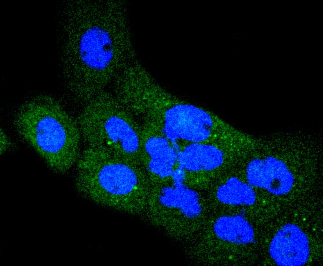 RON Antibody in Immunocytochemistry (ICC/IF)