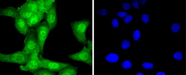 UBE1 Antibody in Immunocytochemistry (ICC/IF)