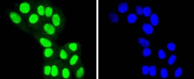 HDAC8 Antibody in Immunocytochemistry (ICC/IF)