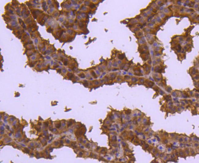 Cdc37 Antibody in Immunohistochemistry (Paraffin) (IHC (P))