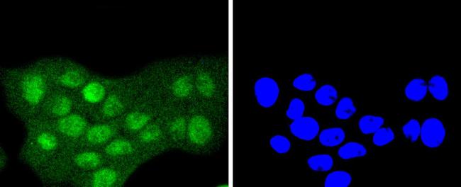 SUMO2/SUMO3 Antibody in Immunocytochemistry (ICC/IF)