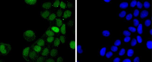 Phospho-c-Jun (Thr91) Antibody in Immunocytochemistry (ICC/IF)