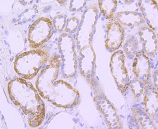 SOD2 (MnSOD) Antibody in Immunohistochemistry (Paraffin) (IHC (P))