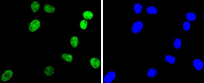 ARID1A Antibody in Immunocytochemistry (ICC/IF)