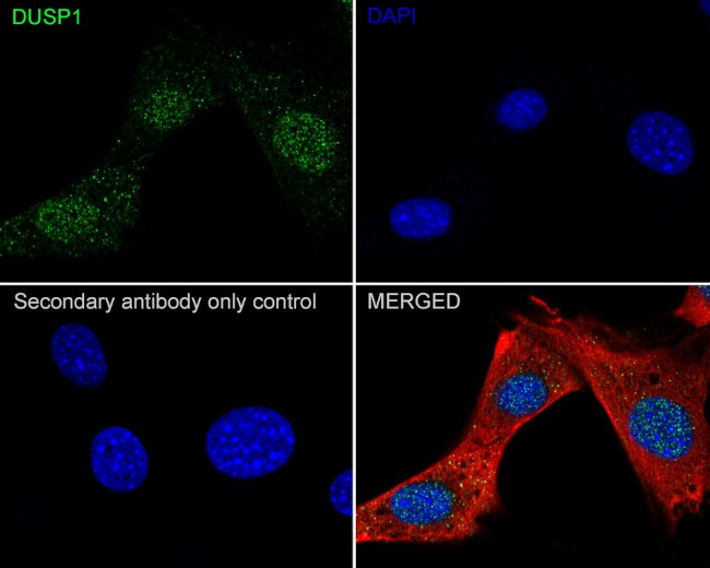 MKP-1 Antibody in Immunocytochemistry (ICC/IF)