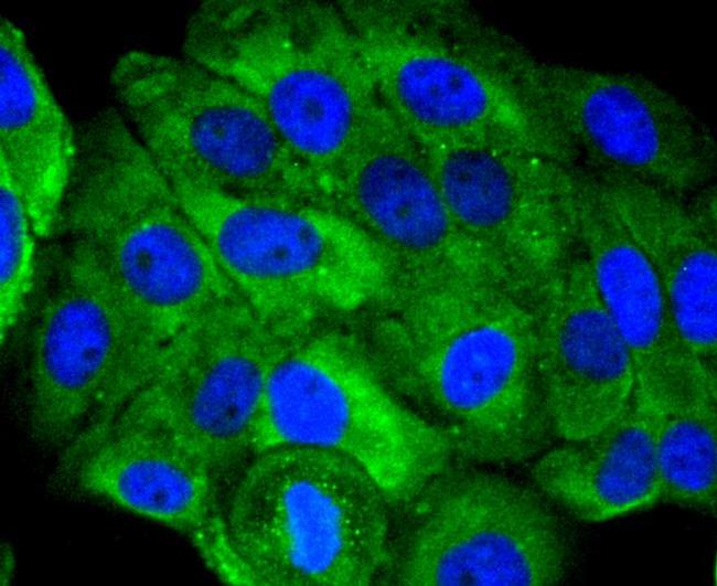 UBD Antibody in Immunocytochemistry (ICC/IF)