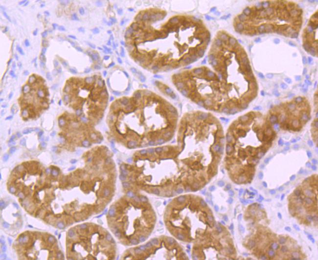 EBP50 Antibody in Immunohistochemistry (Paraffin) (IHC (P))