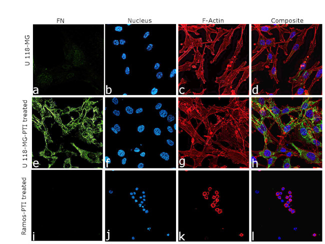 Fibronectin Antibody in Immunocytochemistry (ICC/IF)