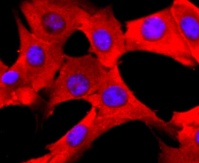 PDIA6 Antibody in Immunocytochemistry (ICC/IF)