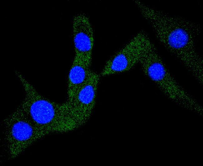 Cardiac Troponin I Antibody in Immunocytochemistry (ICC/IF)