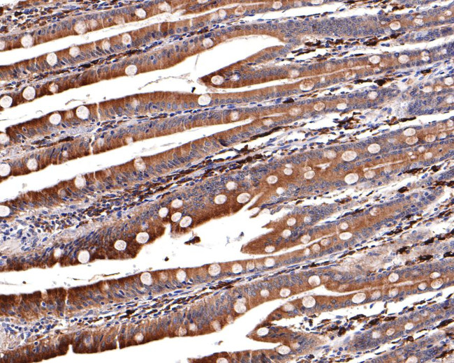 HMGCR Antibody in Immunohistochemistry (Paraffin) (IHC (P))