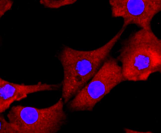 Galectin 3 Antibody in Immunocytochemistry (ICC/IF)