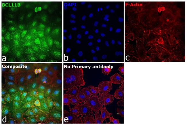 BCL11B Antibody in Immunocytochemistry (ICC/IF)