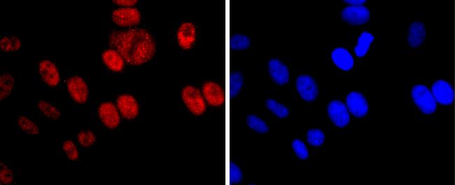 DNMT1 Antibody in Immunocytochemistry (ICC/IF)