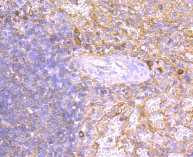 Human IgM Antibody in Immunohistochemistry (Paraffin) (IHC (P))