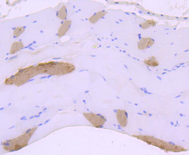 Myosin Heavy Chain Antibody in Immunohistochemistry (Paraffin) (IHC (P))