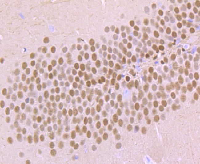 TBR1 Antibody in Immunohistochemistry (Paraffin) (IHC (P))