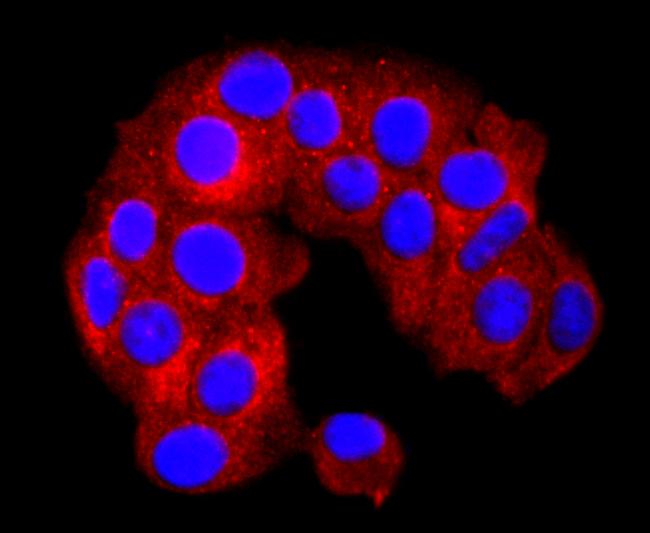 SERCA2 ATPase Antibody in Immunocytochemistry (ICC/IF)