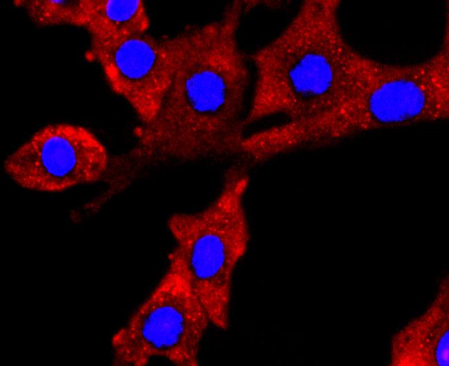 NUMB Antibody in Immunocytochemistry (ICC/IF)