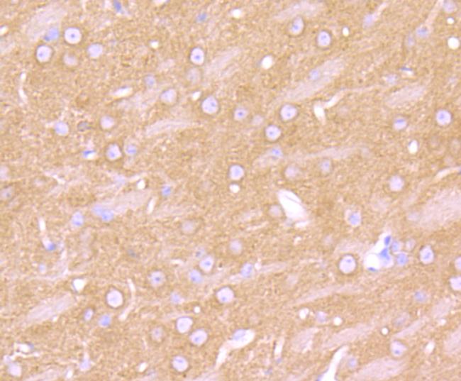 beta-2 Adrenergic Receptor Antibody in Immunohistochemistry (Paraffin) (IHC (P))