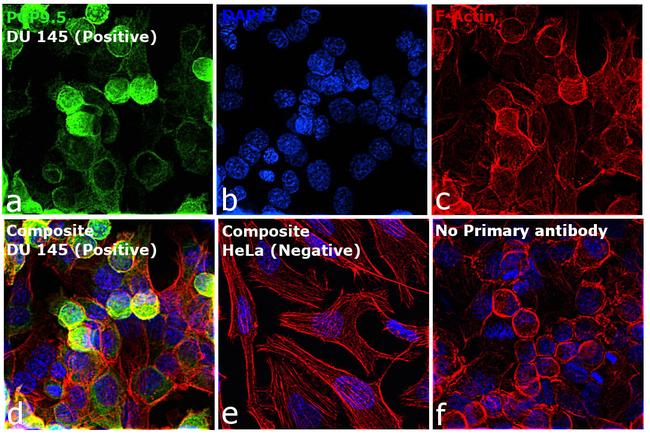 PGP9.5 Antibody in Immunocytochemistry (ICC/IF)