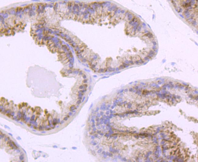 TLR5 Antibody in Immunohistochemistry (Paraffin) (IHC (P))