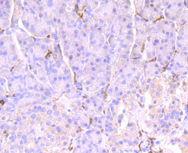 CD32 Antibody in Immunohistochemistry (Paraffin) (IHC (P))