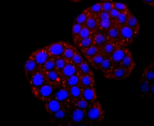 Hemoglobin gamma-1,2 Antibody in Immunocytochemistry (ICC/IF)