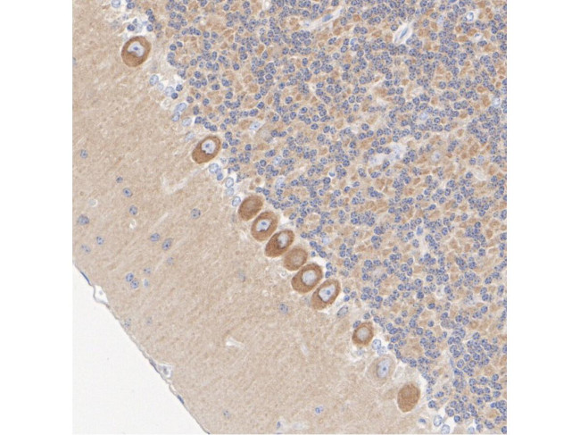 CaMKII alpha Antibody in Immunohistochemistry (Paraffin) (IHC (P))