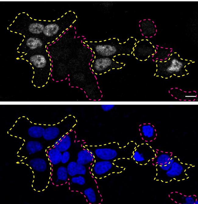 TDP-43 Antibody in Immunocytochemistry (ICC/IF)