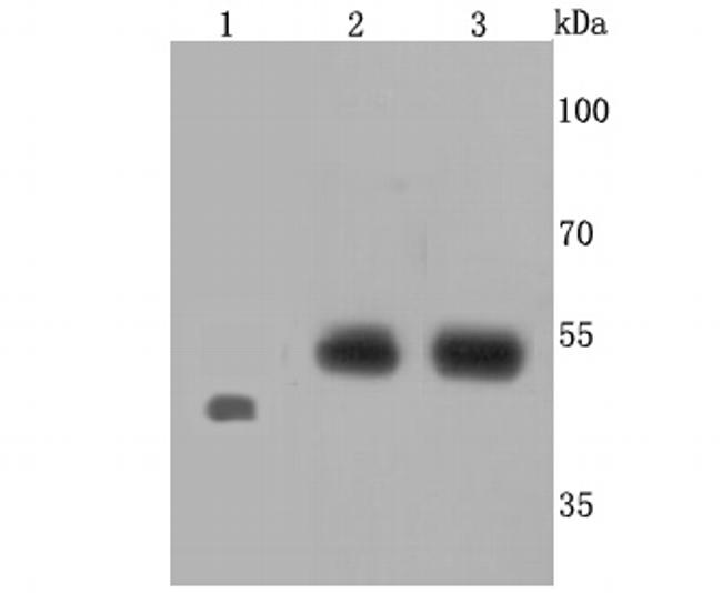 Endothelin B Receptor Antibody in Western Blot (WB)