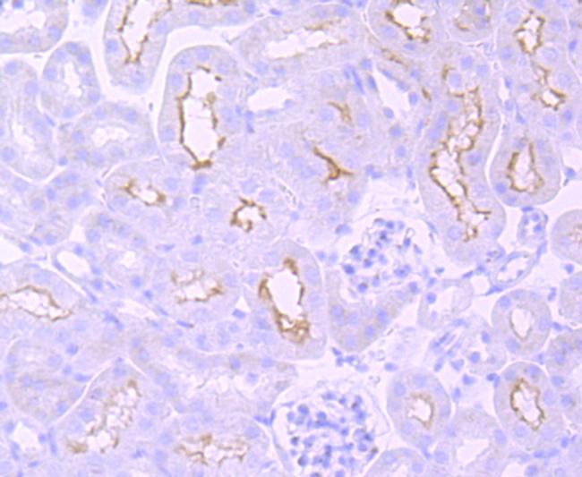 mGluR1 Antibody in Immunohistochemistry (Paraffin) (IHC (P))